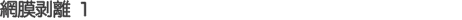 網膜剥離 １
